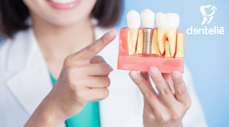 Servidores associados têm vantagens especiais em tratamentos odontológicos